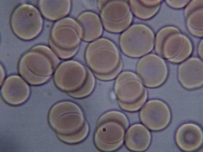 La sangre con un pH normal es fundamental para la homeostasis